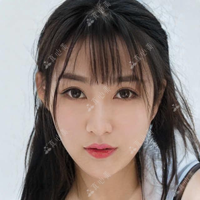 广州微笑唇手术全解:可玫尔、多美整形、可玉医美价格&实例一览表(含恢复时间及护理指南)