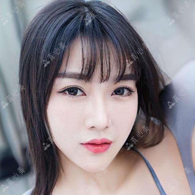 武汉仁爱&武汉显赫毛发种植价格对比表：FUE项目低至5元/单位，助您美丽升级