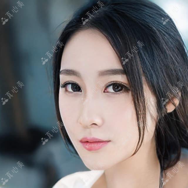 湖州一院眼科陈洪医生：眼表疾病与白内障治疗专家坐诊吴兴区