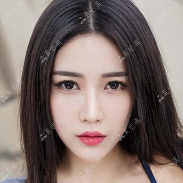 无锡擅长眼部整形的医生推荐,翟爱琴葛茸茸勇中华均在列