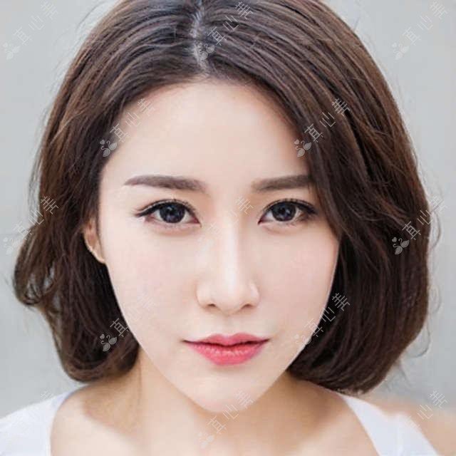 深圳深北爱尔眼科全项目价格揭秘：近视激光&白内障手术等热门医美费用一览