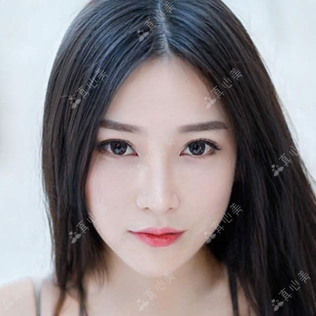 深圳博爱曙光眼科2023项目价格速览：近视全飞秒1.5W+ 半飞秒1.2W+ 晶体植入2.8W+