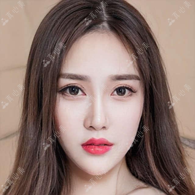 上海复旦闵行医院眼科价格表:近视手术6800元起,附详细项目收费清单!