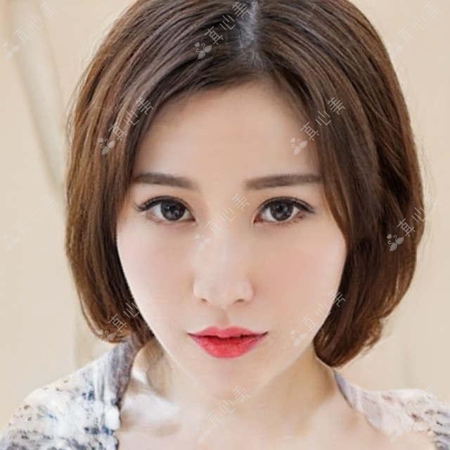 广州市华厦眼科（维尔视）近视矫正费用揭秘？全飞秒亲民价+半飞秒性价比之选+ICL晶体植入高端定制