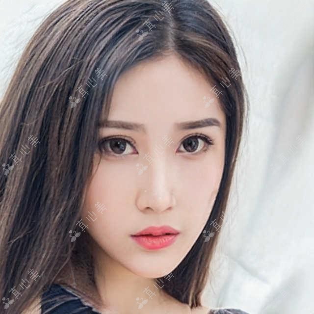 广东深圳陈青华口腔根管治疗多少钱？种植牙8K+/瓷贴面3K+/儿童正畸1W+