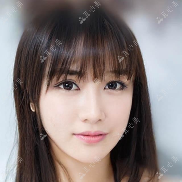 武汉外眼角手术价格一览：青春百年12800起，唯媚美容13500起，新一美整形11800起，武汉外眼角案例与恢复指南
