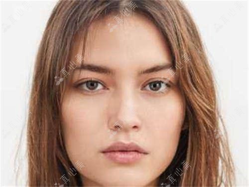 中山韩妃&爱思特凹陷疤痕修复价格表:多面解析祛疤费用与疗效