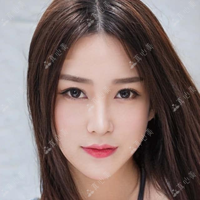 南宁广丽方林均医生:360度超声吸脂与鼻眼整形有名医生