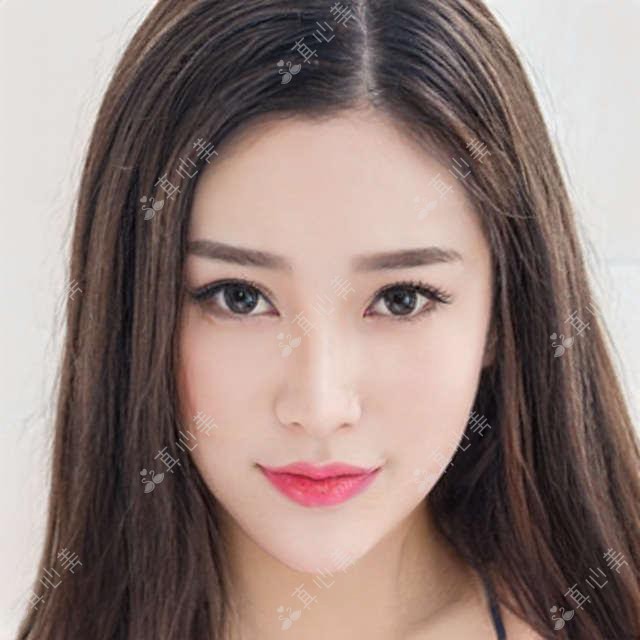 北京微创富贵包手术价格一览:美尔目定慧5168元起,多家医院对比分析