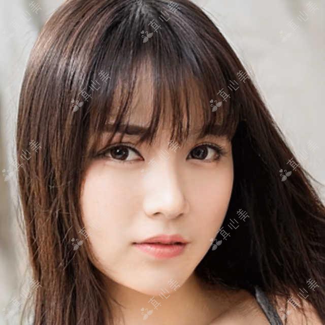 吉林市德国种植牙价格一览：承运/联晟/吉平/嘉美/甘洪蕾种植牙费用对比表