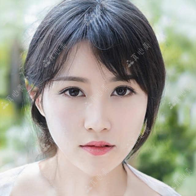 浦南医院vs华东医院：双眼皮与玻尿酸哪家强？上海医美探店实录