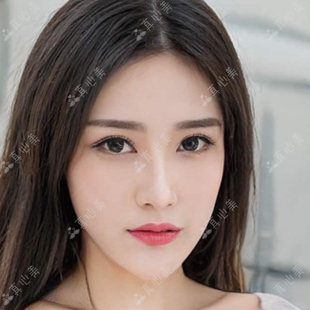 成都圣之隅医美价格揭秘：热门项目如隆鼻眼综合，让你美丽不花冤枉钱