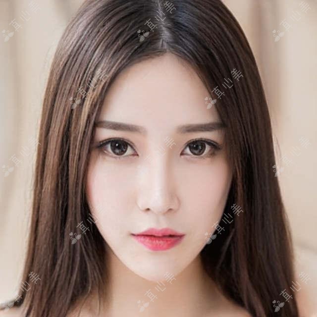 枣庄擅长眼科及整形医生推荐：王兵、王皓月精通青光眼白内障，徐环宇擅美眼塑鼻
