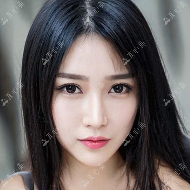 枣庄滕州眼科专家王皓月：滕州市中心人民医院白内障青光眼治疗权威