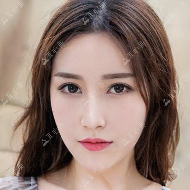 刘亚丽牙齿矫正技术如何?擅长隐形矫正与补牙修复,温州鹿城区口腔医师