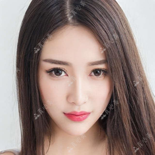 广州番禺普瑞眼科近视矫正价目公开？全飞秒近视手术近2W/半飞秒亲民1W+/ICL晶体植入3W起