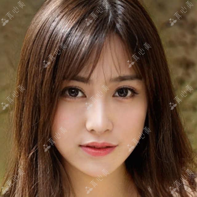 佛山爱顿口腔张耀医生正畸测评：隐形矫正技术娴熟，种植牙修复效果自然持久