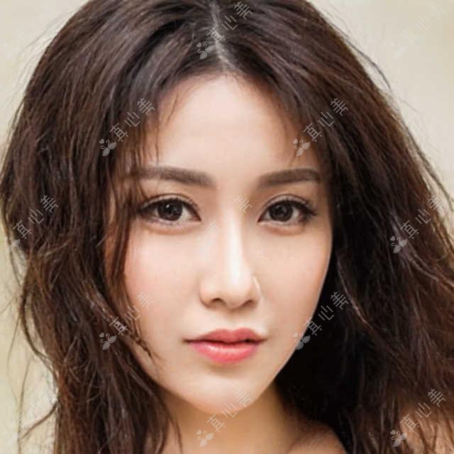 北京熙朵植发全攻略：热门植发项目价格大揭秘