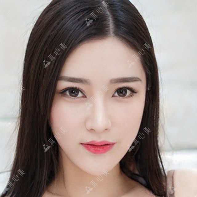 沧州献县众明眼科田国伟医生测评：白内障超声乳化手术精准可靠，青光眼治疗技术专业