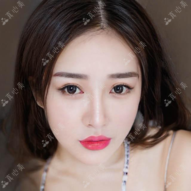 2025南通医美医院排行：康美|俪人连天美吸脂双眼皮价格表曝光，网友直呼“太实用”！