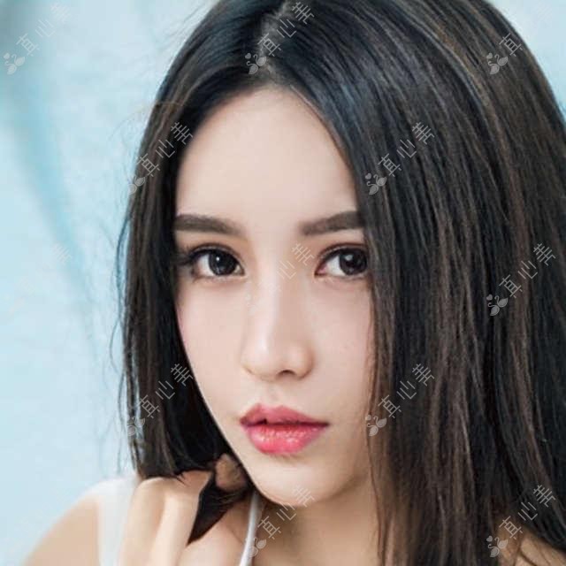 威海天鹅颈项目哪里做得好 价格亲民疗效出众的医美推荐