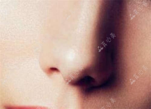 西安赵瑞博医生近视手术口碑好:飞秒激光与白内障手术实例丰富
