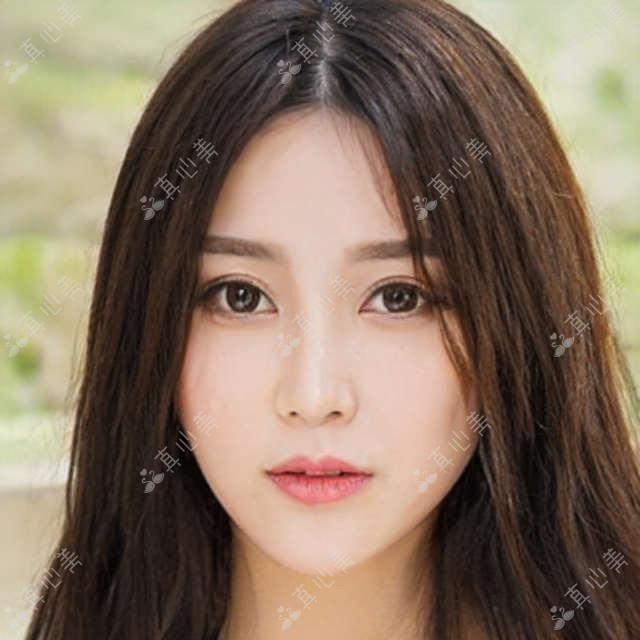 长春徐村媛医生:眼部整形与抗衰老医生,精细眼袋与基因抗衰技术带领者