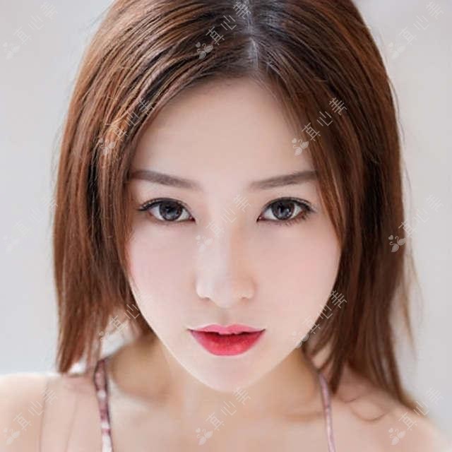 武汉植发哪家强?九州丛琳vs显赫植发真实测评,发际线种植+鬓角修复避坑指南