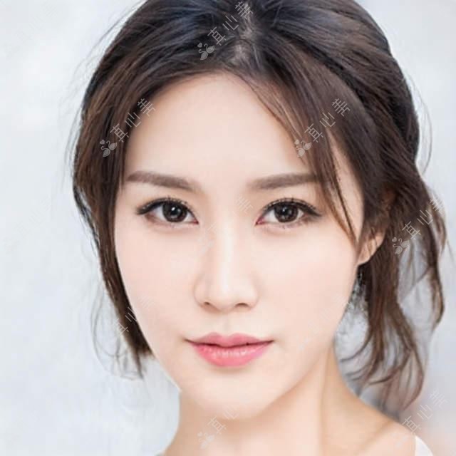 深圳市牙齿贴面医院对比:深圳慧妍、蒙恩齿科、乐檬口腔价格一览表3500起