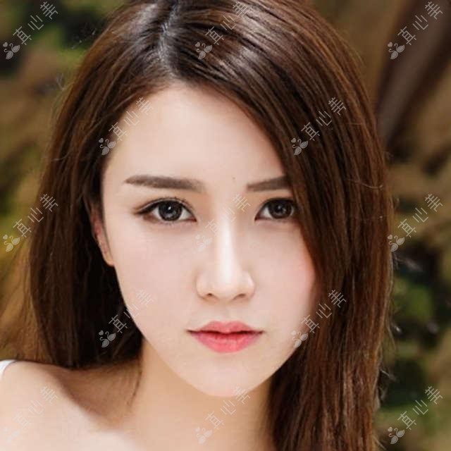 北京市熙仁眼科近视矫正费用揭秘:激光手术亲民价+ICL晶体植入约3W+