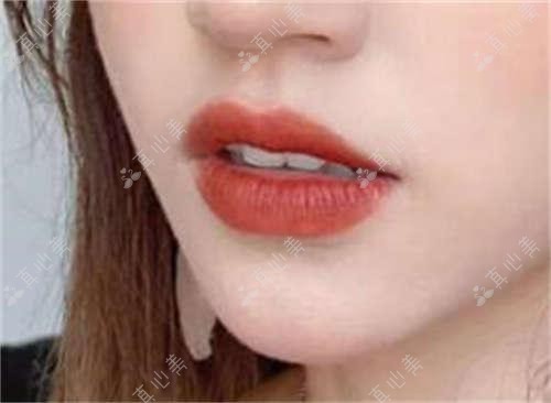 上海近视手术医院排名与价格一览:复旦华东25000起,浦东浦南20000起,六院金山18000起,十院30000起,近视防控与手术特色解读