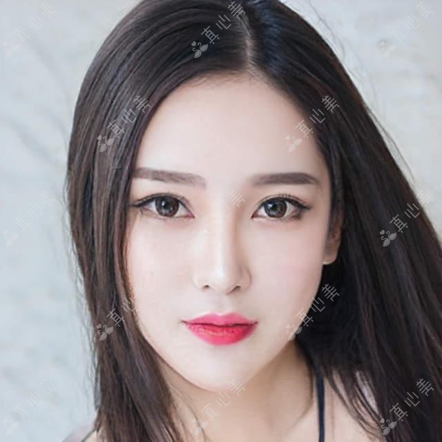 西安口周年轻化避坑指南 这三种东西千万别碰