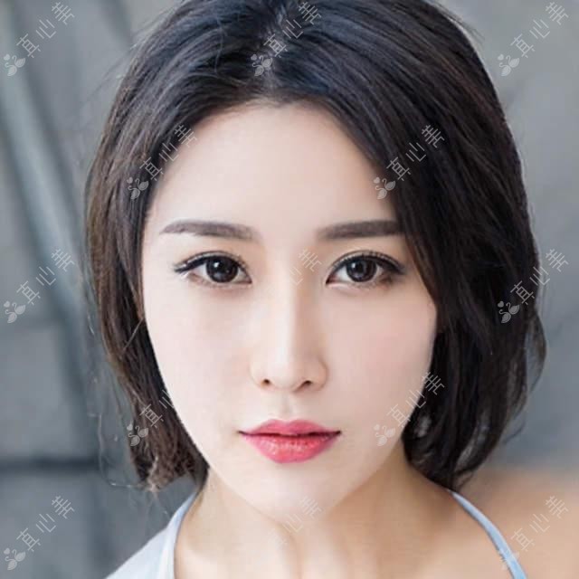 漳州眼科鼻整形医生推荐:马健擅眼科手术,李小丹精眼部鼻整形及抗衰老