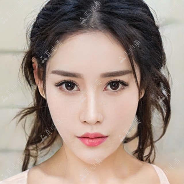 无锡地区眼科医生勇中华陆君如,擅长眼部整形及近视矫正,技术精细受追捧?