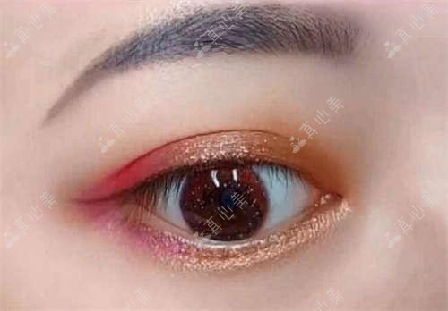 金华眼科医生排行推荐(含近视矫正+费用详情)_近视手术必看