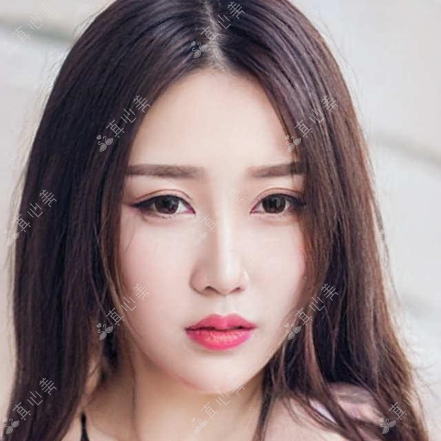 泉州眼科医生高莹莹、李学喜、庄建福力荐近视及弱视矫正方案