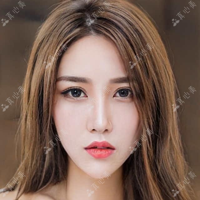 包头眼部整形医生推荐:张诚, 周园, 尹丽霞打造精致双眸