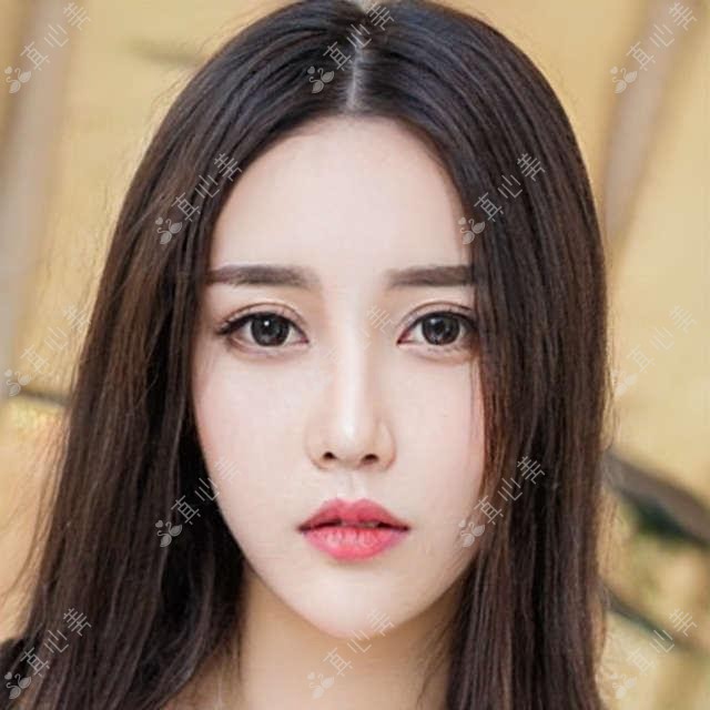 咸阳光子嫩肤医院排名及价格对比 哪家疗效更好更划算