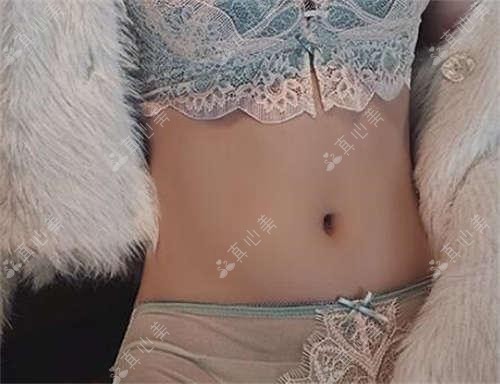 南阳精灵耳项目1.8w值不值?怕疼星人亲测全程较痛感!