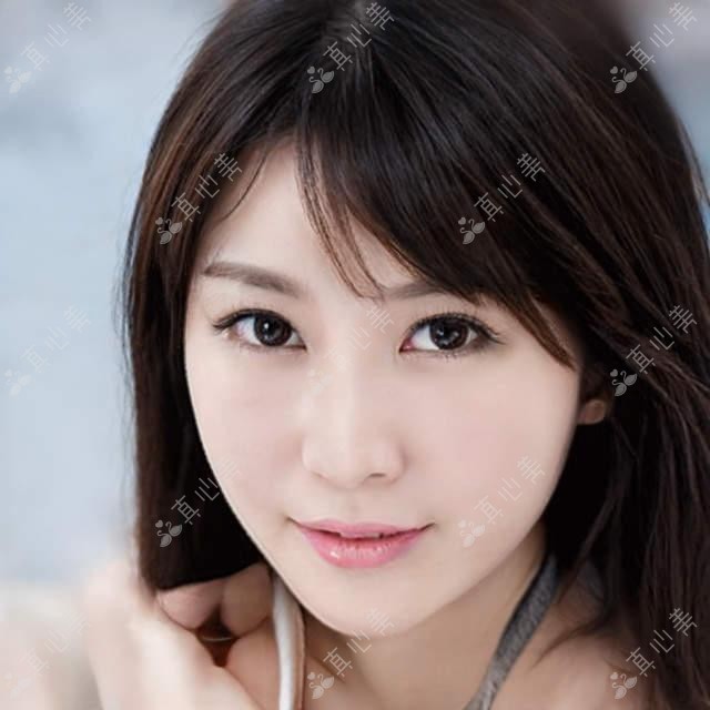 金华玥莱美植发&金华森海:无痕植发仅需5000元起,详解金华市植发医院价格表及实例分析