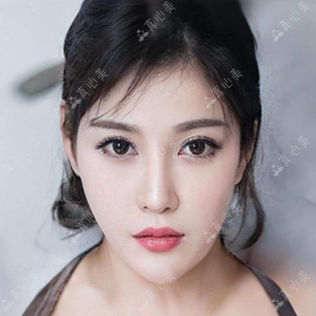 宁德精灵耳和耳软骨塑形怎么选?3k和8k的差别在哪?