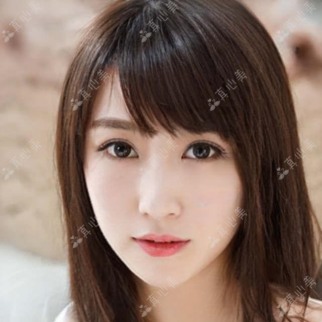 泰州张勤眼科医院院长张勤医生:白内障手术与青少年近视防御医生