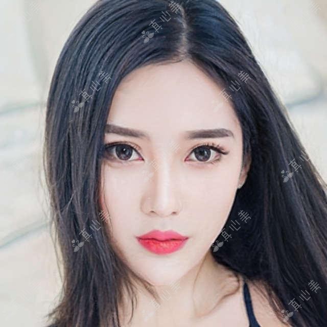 江门近视矫正名医赵春阳汇总盘点！精湛技术广受网友好评！