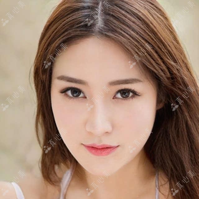 柳州德国蔡司mel90全激光一般多少钱?德国鹰视EX500全激光16000元左右