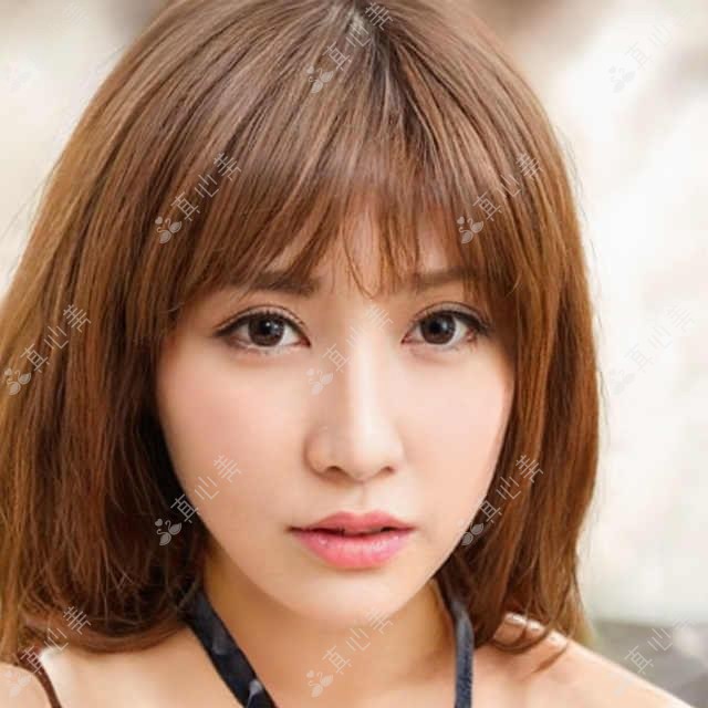 深圳市丽港丽格医美义齿价格揭秘？牙齿矫正2W+ 玻尿酸填充1W+ 激光脱毛5K+