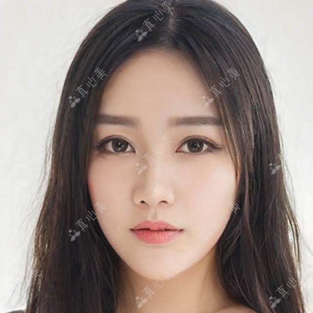 丽水韩国开运桃花眼项目价格与疗效排名解析
