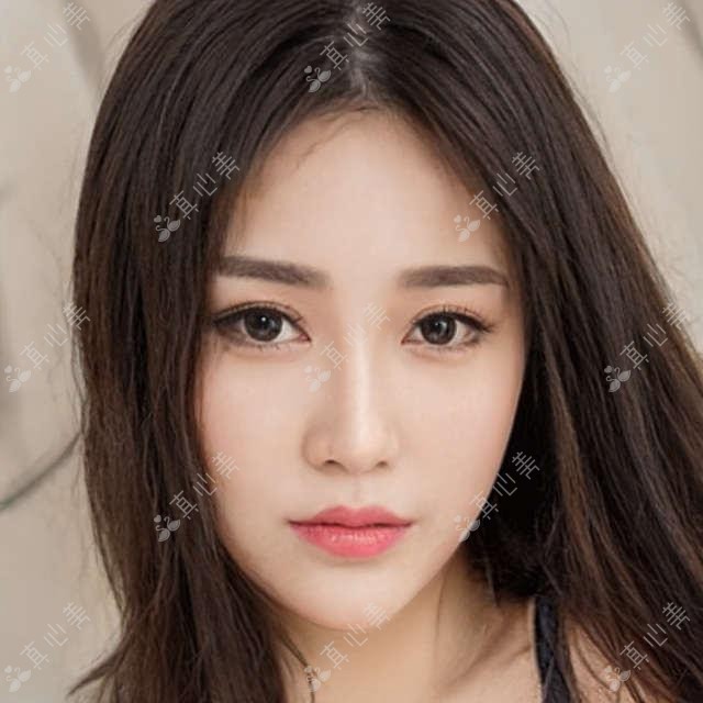 德州人民医院眼科梁玲医生全飞秒近视手术与白内障治疗医生解析
