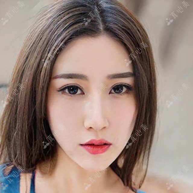 深圳丽港丽格医美价格表:大腿吸脂9800+|腰腹吸脂12800+|面部填充6800+,深圳地区整形医院项目费用一览