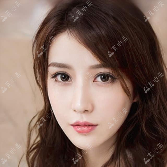 寻重庆叶剑汪红郑汉做全飞秒ICL，近视手术效果佳