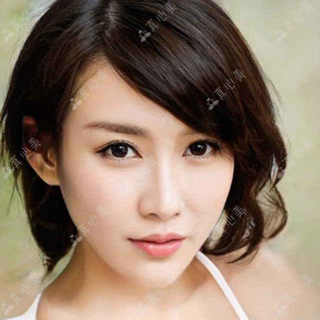 驻马店丰苹果肌价格表来啦!附本地靠谱医院推荐,看完不踩坑